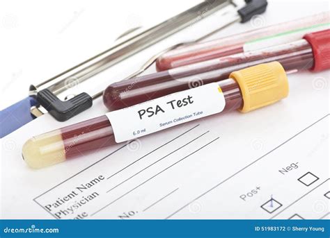 psa blood test bottle|psa blood test patient information.